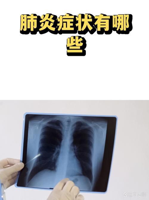 【广安区无症状感染者已反弹29地_广安感染肺炎最新消息】